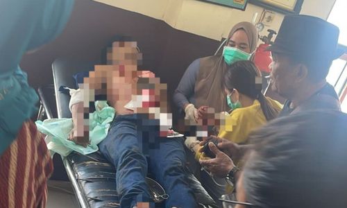 Tukang Cukur Bacok Pelanggan di Morowali Gegara Hasil Pangkas Rambut Diprotes